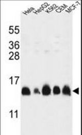 HIST1H2AL Antibody western blot of HL-60,HepG2,K562,CEM,MCF-7 cell line lysates (35 ug/lane). The HIST1H2AL antibody detected the HIST1H2AL protein (arrow).
