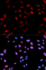 Immunofluorescence analysis of U2OS cell using Phospho-HIST1H3B-T12 antibody. Blue: DAPI for nuclear staining.