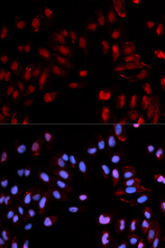 Immunofluorescence analysis of U2OS cell using Phospho-HIST1H3B-S29 antibody. Blue: DAPI for nuclear staining.