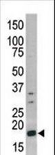 Western blot of anti-Phospho-H3-pS10 antibody in CEM cell line lysate (35 ug/lane). Phospho-H3-pS10(arrow) was detected using the purified antibody.