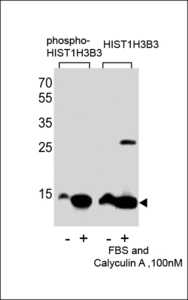 Western blot of extracts from HeLa cells,untreated or treated with FBS and Calyculin A ,100nM, using phospho-HIST1H3B3-S10(left) or HIST1H3B3 antibody(right)
