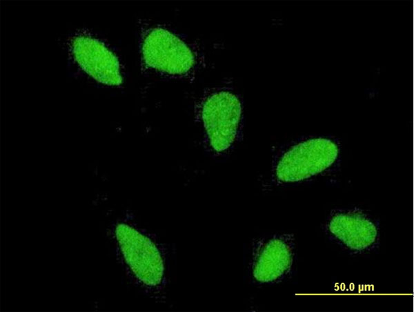 Immunofluorescence of monoclonal antibody to HIST2H2AA3 on HeLa cell . [antibody concentration 10 ug/ml]