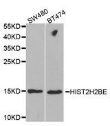 Western blot analysis of extracts of various cell lines, using HIST2H2BE antibody.