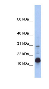 HIST2H2BF antibody LS-C111846 Western blot of Fetal Small Intestine lysate.