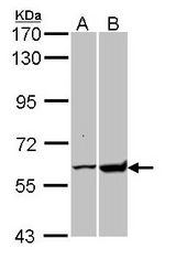 Sample (30 ug of whole cell lysate). A: H1299. B: Raji. 7.5% SDS PAGE. GPI antibody diluted at 1:10000.