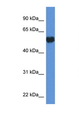 GPI antibody LS-C135916 Western blot of HepG2 Cell lysate. Antibody concentration 1 ug/ml.