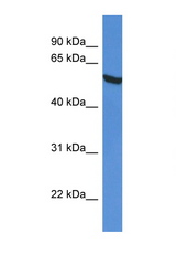 GPI antibody LS-C135917 Western blot of HepG2 Cell lysate. Antibody concentration 1 ug/ml.