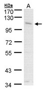 Sample (30 ug of whole cell lysate). A: A431 . 7.5% SDS PAGE. GOB5 / CLCA1 antibody diluted at 1:1000