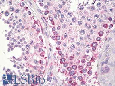 Anti-HIWI2 / PIWIL4 antibody IHC staining of human testis, spermatogonia. Immunohistochemistry of formalin-fixed, paraffin-embedded tissue after heat-induced antigen retrieval.