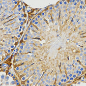 Immunohistochemistry of paraffin-embedded rat testis tissue using PIWIL4 antibody at dilution of 1:200 (x400 lens).