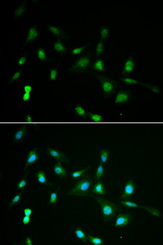 Immunofluorescence analysis of A549 cell using PIWIL4 antibody. Blue: DAPI for nuclear staining.