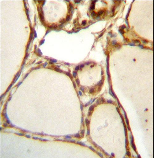 HJURP Antibody immunohistochemistry of formalin-fixed and paraffin-embedded human thyroid tissue followed by peroxidase-conjugated secondary antibody and DAB staining.