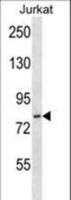 HJURP Antibody western blot of Jurkat cell line lysates (35 ug/lane). The HJURP antibody detected the HJURP protein (arrow).