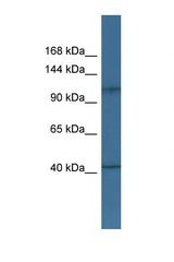 HK1 / Hexokinase 1 antibody LS-C135912 Western blot of Fetal Heart lysate. Antibody concentration 1 ug/ml.