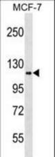 HK1 Antibody (L93) western blot of MCF-7 cell line lysates (35 ug/lane). The HK1 antibody detected the HK1 protein (arrow).