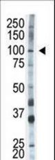 The anti-HK1 antibody is used in Western blot to detect HK1 in mouse skeletal muscle tissue lysate.