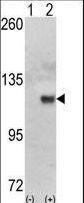 Western blot of HK1 (arrow) using HK1 Antibody. 293 cell lysates (2 ug/lane) either nontransfected (Lane 1) or transiently transfected with the HK1 gene (Lane 2) (Origene Technologies).
