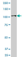 HK2 monoclonal antibody (M01), clone 4H1. Western Blot analysis of HK2 expression in A-431.