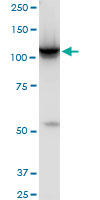 HK2 monoclonal antibody (M01), clone 4H1. Western Blot analysis of HK2 expression in PC-12.