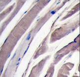 Formalin-fixed and paraffin-embedded human skeletal muscle tissue reacted with HK2 antibody , which was peroxidase-conjugated to the secondary antibody, followed by DAB staining. This data demonstrates the use of this antibody for immunohistochemistry; clinical relevance has not been evaluated.