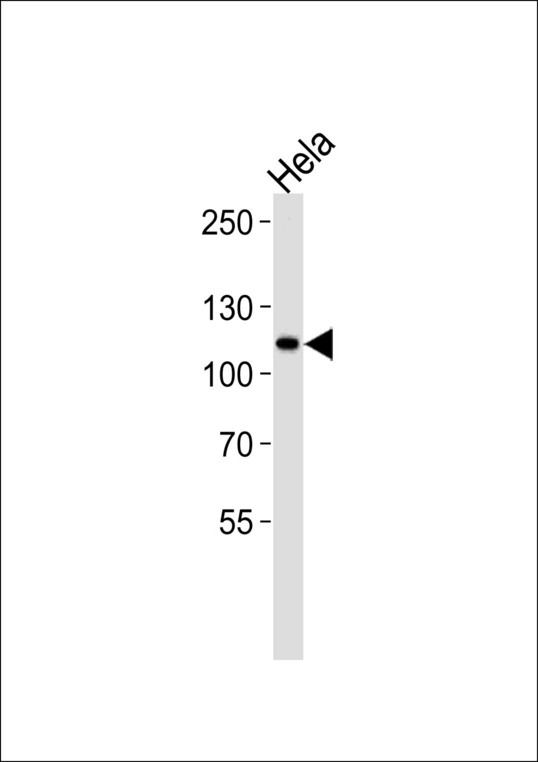 HK2 Antibody (E106) western blot of HeLa cell line lysates (35 ug/lane). The HK2 antibody detected the HK2 protein (arrow).