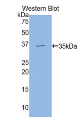 Western blot of recombinant HK2 / Hexokinase 2.