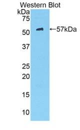 Western blot of recombinant HK2 / Hexokinase 2.