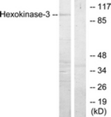Western blot of extracts from Jurkat cells, treated with insulin 0.01U/ml 15', using Hexokinase-3 Antibody. The lane on the right is treated with the synthesized peptide.