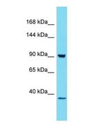 Western blot of HKDC1 Antibody - C-terminal region with human 293T cells lysate.