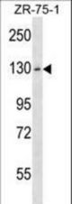 HKDC1 Antibody western blot of ZR-75-1 cell line lysates (35 ug/lane). The HKDC1 antibody detected the HKDC1 protein (arrow).