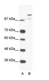 A: Marker, B: Jurkat Cell Lysate