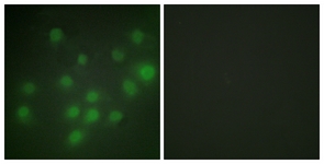 Immunofluorescence of HUVEC cells, using HKR1 Antibody. The picture on the right is treated with the synthesized peptide.