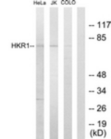 Western blot of extracts from HeLa/Jurkat/COLO205 cells, using HKR1 Antibody. The lane on the right is treated with the synthesized peptide.