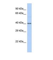 Western blot of Human HeLa. HKR1 antibody dilution 1.0 ug/ml.