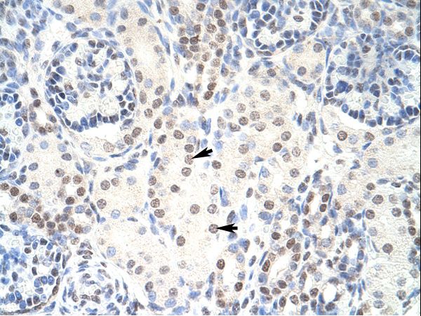 HKR1 antibody LS-C30263 was used in IHC to stain formalin-fixed, paraffin-embedded human kidney.