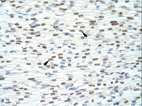 HKR1 antibody LS-C30263 was used in IHC to stain formalin-fixed, paraffin-embedded human heart.