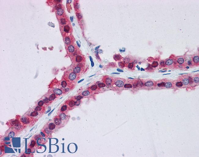 Anti-GPI antibody IHC of human thyroid. Immunohistochemistry of formalin-fixed, paraffin-embedded tissue after heat-induced antigen retrieval. Antibody LS-B4412 concentration 3.75 ug/ml.