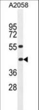 HLA-B Antibody western blot of A2058 cell line lysates (35 ug/lane). The HLA-B antibody detected the HLA-B protein (arrow).