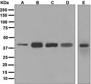 Western blot analysis on (A) Jurkat, (B) human melanoma, (C) human placenta, (D) 293T, and (E) A375 lysates using anti-HLA-C antibody.
