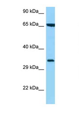 HLA-C antibody LS-C146237 Western blot of 435S Cell lysate. Antibody concentration 1 ug/ml.