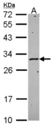 Sample (30 ug of whole cell lysate). A: Hela. 12% SDS PAGE. HLA-DMA antibody diluted at 1:1000.