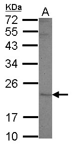 Sample (30 ug of whole cell lysate) A: A431 12% SDS PAGE HLA-DMA antibody diluted at 1:1000