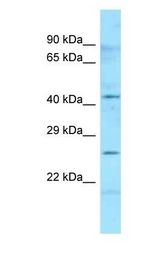 HLA-DMB antibody Western Blot of Human Placenta. Antibody dilution: 1 ug/ml.