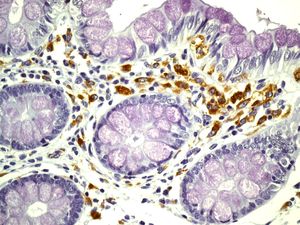 IHC of paraffin-embedded human colon tissue using anti-HLA-DMB antibody.