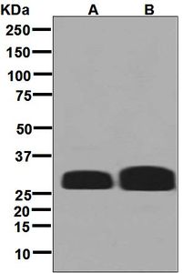 Western blot analysis on (A) Raji and (B) Daudi cell lysates using anti-HLA-DMB antibody.