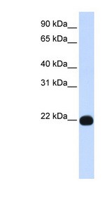PIGA antibody LS-C111022 Western blot of Placenta lysate.