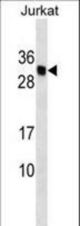 HLA-DMB Antibody western blot of Jurkat cell line lysates (35 ug/lane). The HLA-DMB antibody detected the HLA-DMB protein (arrow).