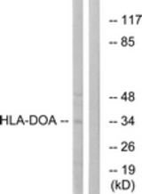 Western blot of extracts from COLO cells, using HLA-DOA Antibody. The lane on the right is treated with the synthesized peptide.