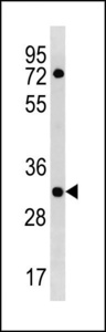 HLA-DOA Antibody western blot of HL-60 cell line lysates (35 ug/lane). The HLA-DOA antibody detected the HLA-DOA protein (arrow).