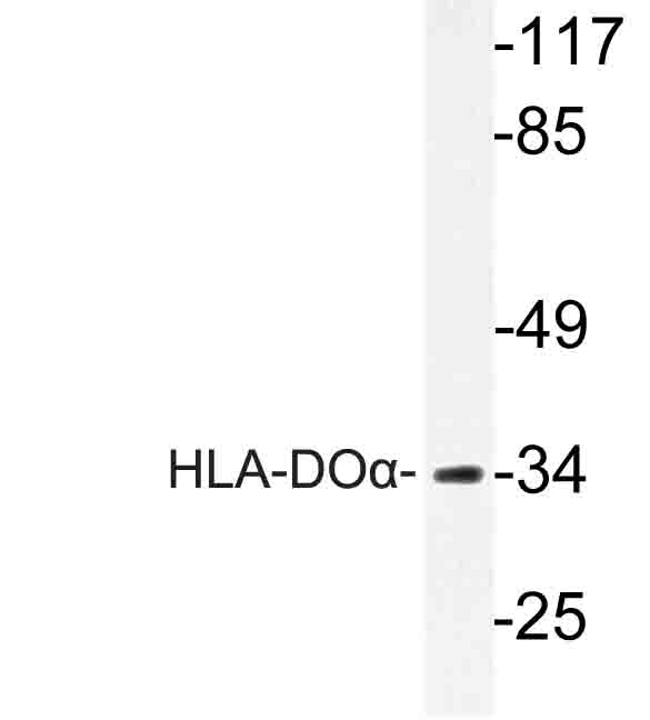 Western blot of HLA-DO (V111) pAb in extracts from COLO cells.